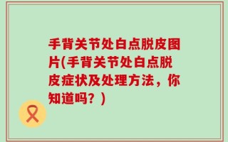 手背关节处白点脱皮图片(手背关节处白点脱皮症状及处理方法，你知道吗？)