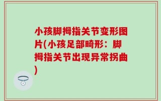 小孩脚拇指关节变形图片(小孩足部畸形：脚拇指关节出现异常拐曲)