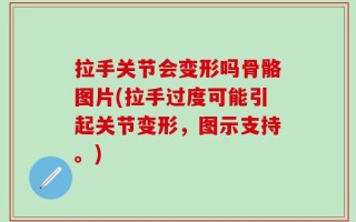 拉手关节会变形吗骨骼图片(拉手过度可能引起关节变形，图示支持。)