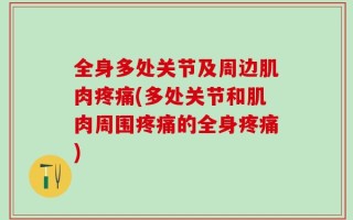 全身多处关节及周边肌肉疼痛(多处关节和肌肉周围疼痛的全身疼痛)