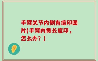 手臂关节内侧有痘印图片(手臂内侧长痘印，怎么办？)