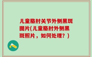 儿童胳肘关节外侧黑斑图片(儿童胳肘外侧黑斑照片，如何处理？)