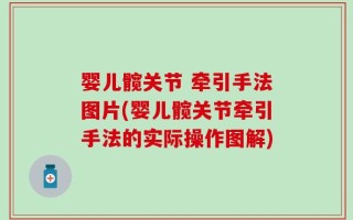婴儿髋关节 牵引手法图片(婴儿髋关节牵引手法的实际操作图解)