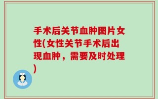 手术后关节血肿图片女性(女性关节手术后出现血肿，需要及时处理)
