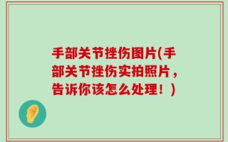 手部关节挫伤图片(手部关节挫伤实拍照片，告诉你该怎么处理！)