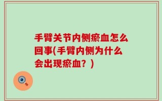 手臂关节内侧瘀血怎么回事(手臂内侧为什么会出现瘀血？)