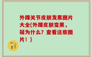 外踝关节皮肤发黑图片大全(外踝皮肤变黑，疑为什么？查看这些图片！)