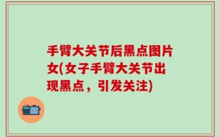手臂大关节后黑点图片女(女子手臂大关节出现黑点，引发关注)