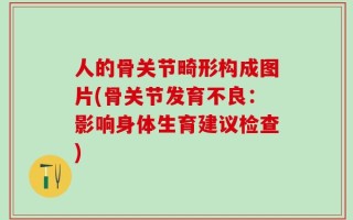 人的骨关节畸形构成图片(骨关节发育不良：影响身体生育建议检查)