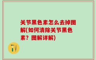 关节黑色素怎么去掉图解(如何清除关节黑色素？图解详解)
