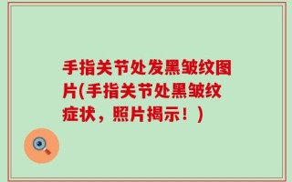 手指关节处发黑皱纹图片(手指关节处黑皱纹症状，照片揭示！)