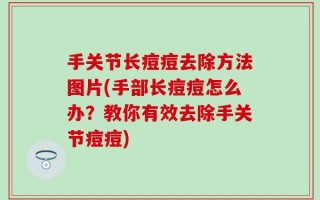 手关节长痘痘去除方法图片(手部长痘痘怎么办？教你有效去除手关节痘痘)