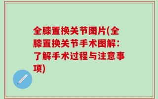 全膝置换关节图片(全膝置换关节手术图解：了解手术过程与注意事项)