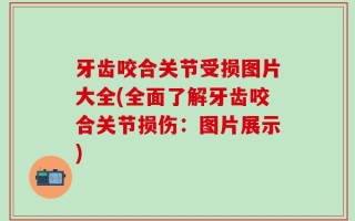 牙齿咬合关节受损图片大全(全面了解牙齿咬合关节损伤：图片展示)