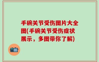 手碗关节受伤图片大全图(手碗关节受伤症状展示，多图带你了解)