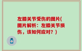 左膝关节受伤的图片(图片解析：左膝关节损伤，该如何应对？)