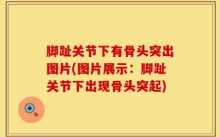 脚趾关节下有骨头突出图片(图片展示：脚趾关节下出现骨头突起)