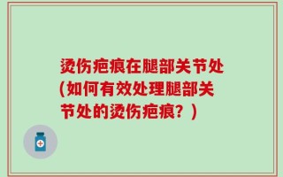 烫伤疤痕在腿部关节处(如何有效处理腿部关节处的烫伤疤痕？)