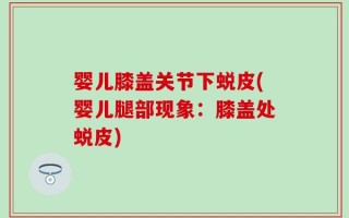 婴儿膝盖关节下蜕皮(婴儿腿部现象：膝盖处蜕皮)