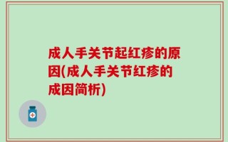 成人手关节起红疹的原因(成人手关节红疹的成因简析)