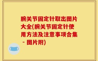腕关节固定针取出图片大全(腕关节固定针使用方法及注意事项合集 - 图片附)