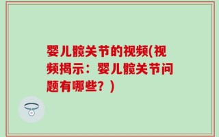 婴儿髋关节的视频(视频揭示：婴儿髋关节问题有哪些？)