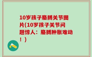 10岁孩子胳膊关节图片(10岁孩子关节问题惊人：胳膊肿胀难动！)