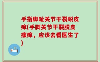 手指脚趾关节干裂蜕皮痒(手脚关节干裂脱皮瘙痒，应该去看医生了)