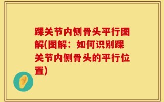 踝关节内侧骨头平行图解(图解：如何识别踝关节内侧骨头的平行位置)