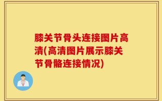 膝关节骨头连接图片高清(高清图片展示膝关节骨骼连接情况)