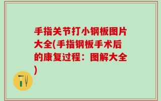 手指关节打小钢板图片大全(手指钢板手术后的康复过程：图解大全)