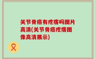 关节骨癌有疙瘩吗图片高清(关节骨癌疙瘩图像高清展示)