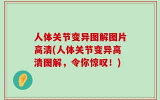 人体关节变异图解图片高清(人体关节变异高清图解，令你惊叹！)