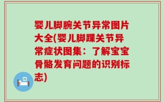 婴儿脚腕关节异常图片大全(婴儿脚踝关节异常症状图集：了解宝宝骨骼发育问题的识别标志)