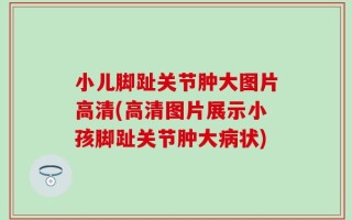 小儿脚趾关节肿大图片高清(高清图片展示小孩脚趾关节肿大病状)