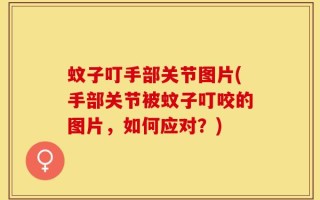蚊子叮手部关节图片(手部关节被蚊子叮咬的图片，如何应对？)