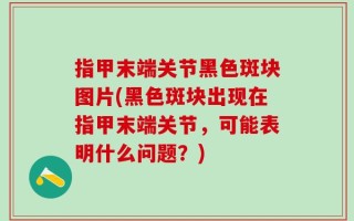指甲末端关节黑色斑块图片(黑色斑块出现在指甲末端关节，可能表明什么问题？)