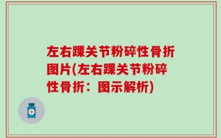左右踝关节粉碎性骨折图片(左右踝关节粉碎性骨折：图示解析)