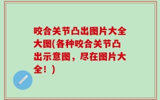 咬合关节凸出图片大全大图(各种咬合关节凸出示意图，尽在图片大全！)
