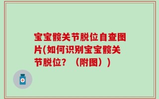 宝宝髋关节脱位自查图片(如何识别宝宝髋关节脱位？（附图）)