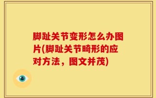 脚趾关节变形怎么办图片(脚趾关节畸形的应对方法，图文并茂)