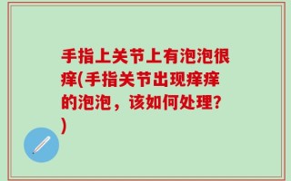 手指上关节上有泡泡很痒(手指关节出现痒痒的泡泡，该如何处理？)