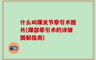 什么叫踝关节牵引术图片(踝部牵引术的详细图解指南)