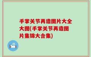 手掌关节再造图片大全大图(手掌关节再造图片集锦大合集)