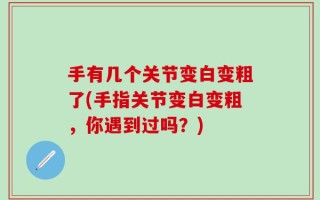 手有几个关节变白变粗了(手指关节变白变粗，你遇到过吗？)