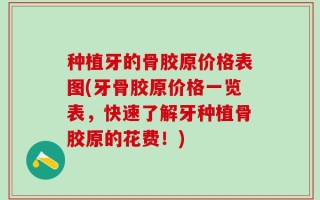 种植牙的骨胶原价格表图(牙骨胶原价格一览表，快速了解牙种植骨胶原的花费！)