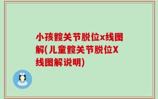 小孩髋关节脱位x线图解(儿童髋关节脱位X线图解说明)
