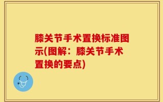 膝关节手术置换标准图示(图解：膝关节手术置换的要点)