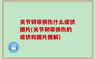 关节韧带损伤什么症状图片(关节韧带损伤的症状和图片图解)