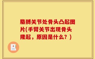 胳膊关节处骨头凸起图片(手臂关节出现骨头隆起，原因是什么？)